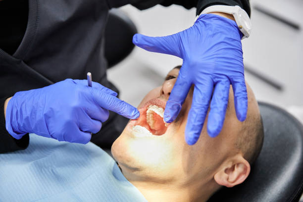Best Lost Filling or Crown Replacement in Havana, IL